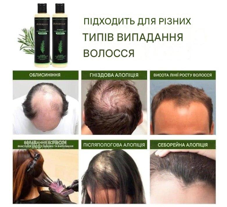 Alisandra шампунь